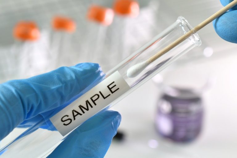 testing-swab-being-inserted-test-tube-labeled-sample-positive-negative-results-lab-laboratory-flu_t20_VWxprl